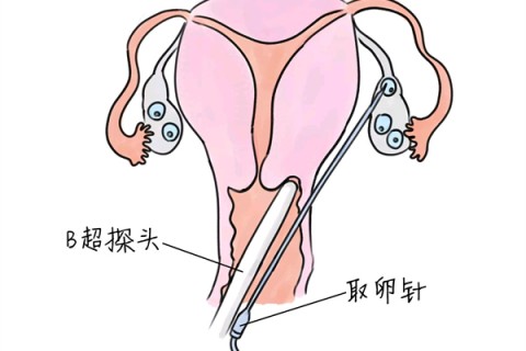 http://changchun.vdtfzz.com/post/205.html|长春供卵助孕